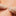 MicroMend Emergency Skin Closure_39495286620355-5
