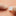 MicroMend Emergency Skin Closure_39495286620355-6